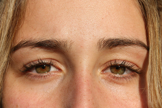 Unveiling the Best Skin Regimen for Rosacea: A Comprehensive Guide